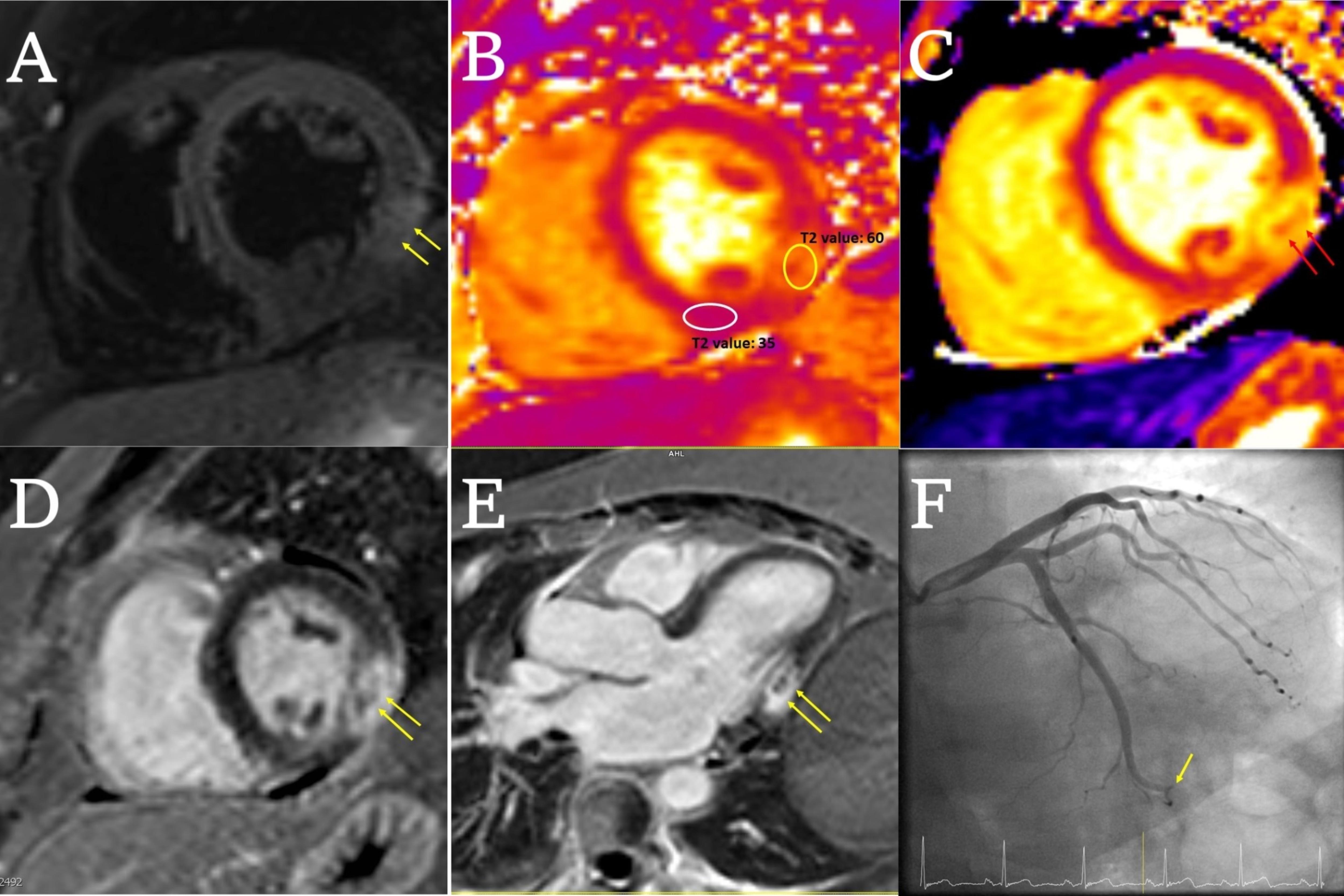 Cardiac magnetic resonance imaging can identify a diagnosis in ...